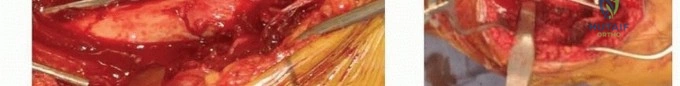 Clinical Image