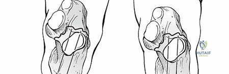 Clinical Image