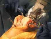 Clinical Image