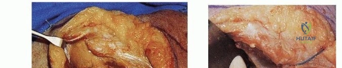 Clinical Image