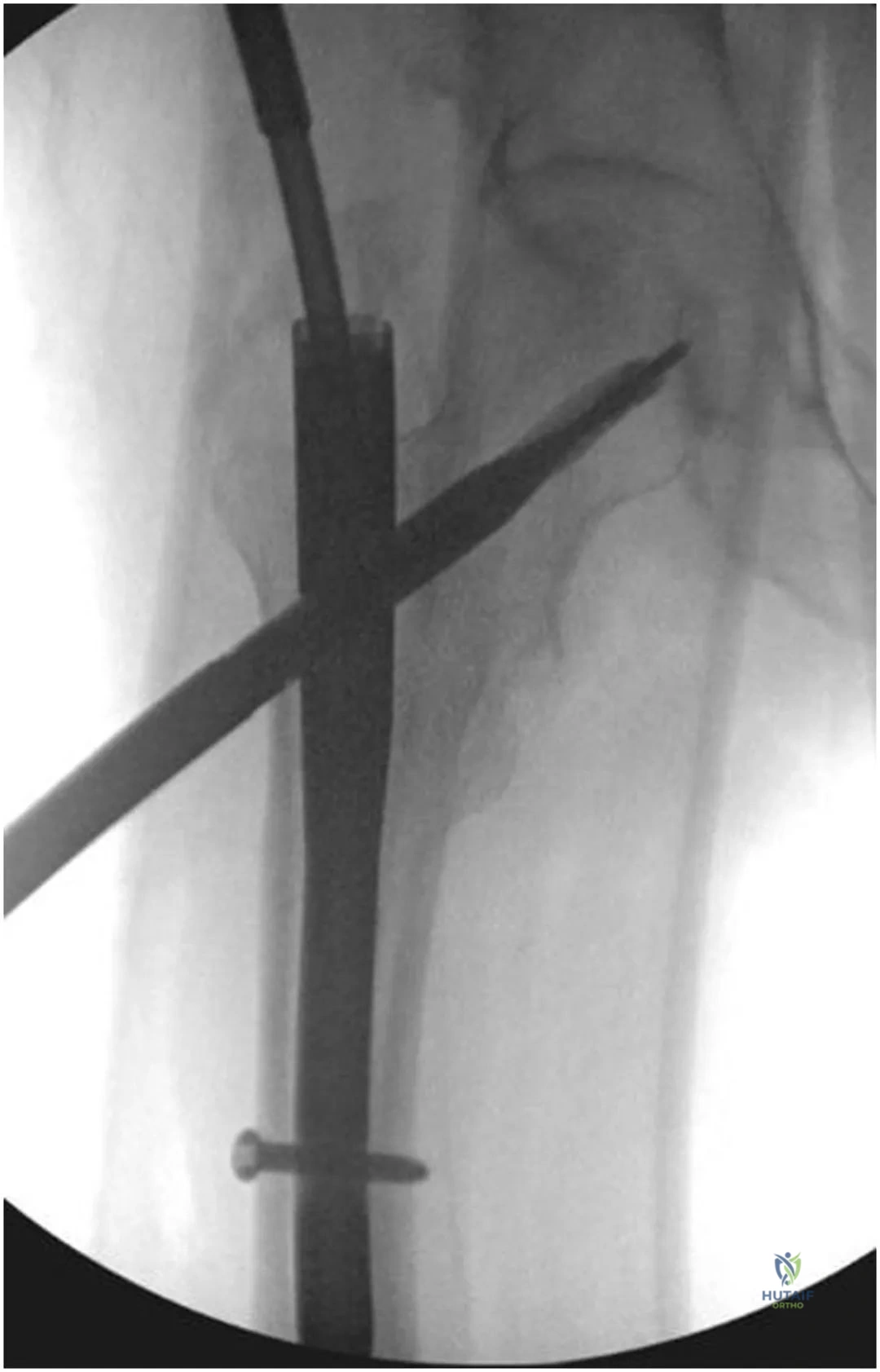 Clinical Image