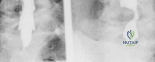 Clinical Image