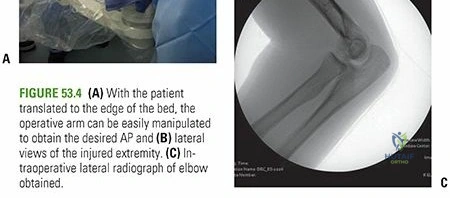 Clinical Image