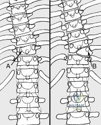 Clinical Image