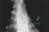 Clinical Image