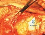 Clinical Image