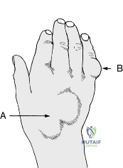 Clinical Image