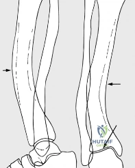 Clinical Image