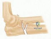 Clinical Image