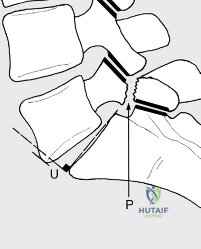 Clinical Image