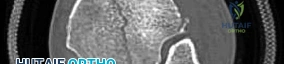 Clinical Image