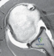 Clinical Image