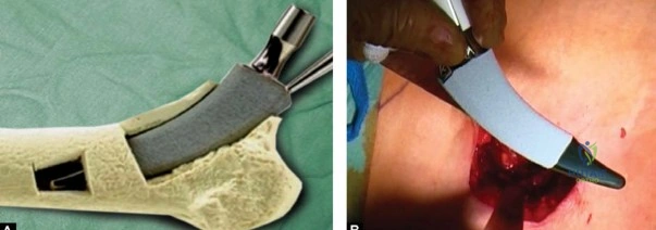 Clinical Image