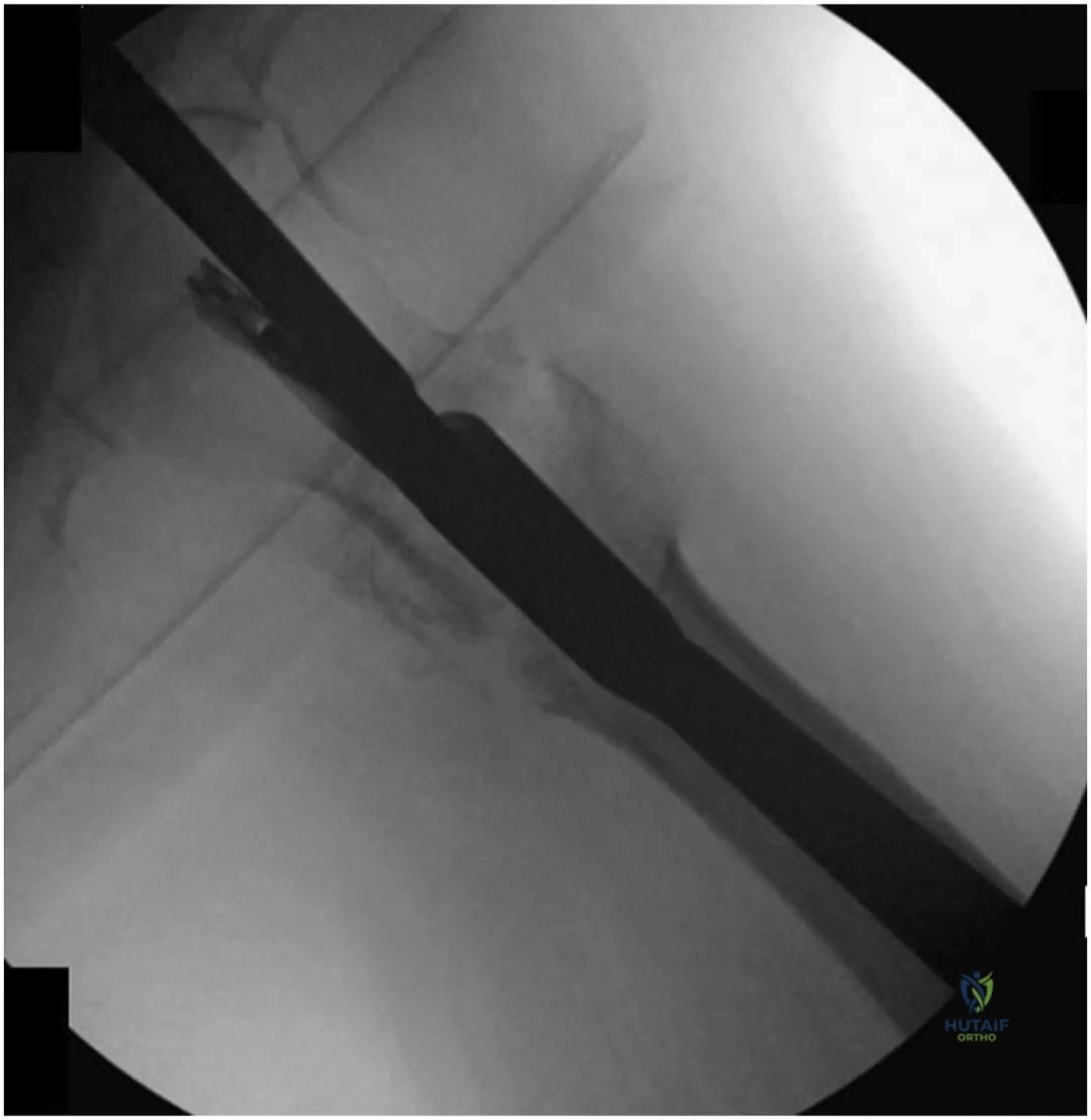 Clinical Image