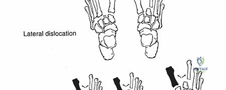 Clinical Image