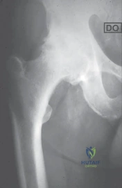 Clinical Image