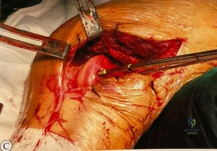 Clinical Image
