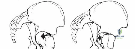 Clinical Image