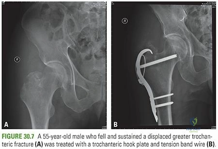 Clinical Image