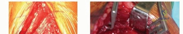 Clinical Image