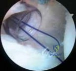 Clinical Image
