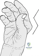Clinical Image