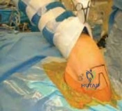 Clinical Image