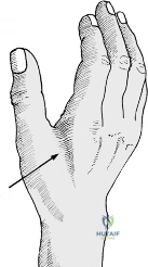 Clinical Image