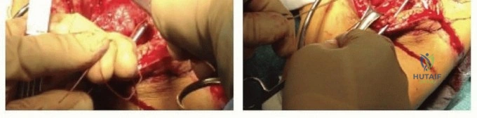 Clinical Image
