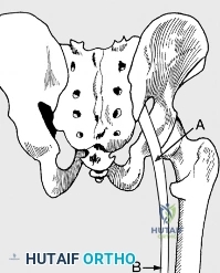 Clinical Image