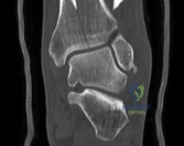 Clinical Image