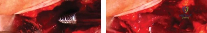 Clinical Image