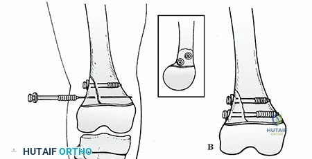 Clinical Image