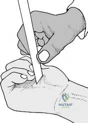 Clinical Image