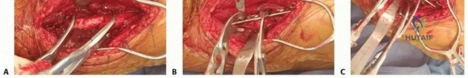 Clinical Image