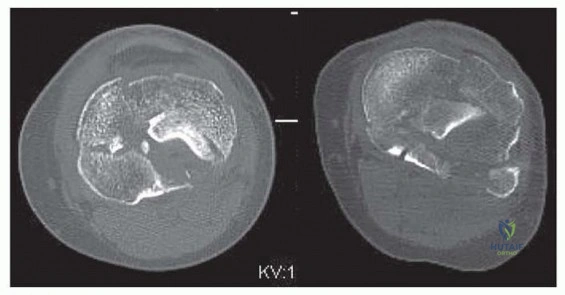 Clinical Image