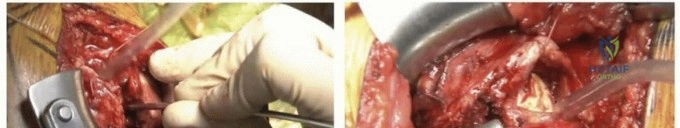 Clinical Image