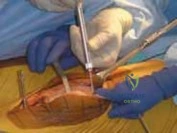 Clinical Image