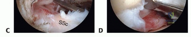 Clinical Image