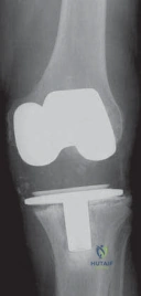Clinical Image