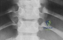 Clinical Image