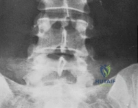 Clinical Image