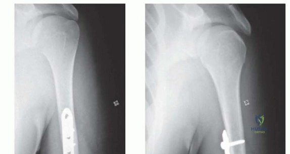Clinical Image
