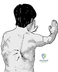 Clinical Image