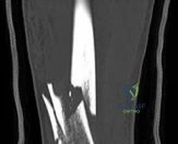 Clinical Image