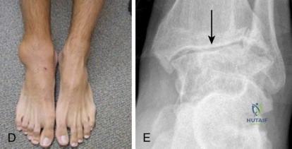 Clinical Image