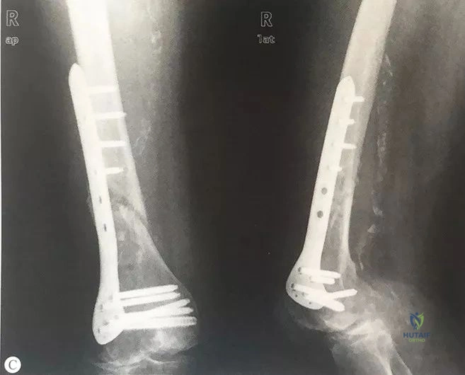 Clinical Image