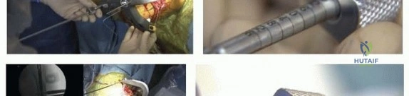 Clinical Image