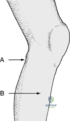 Clinical Image