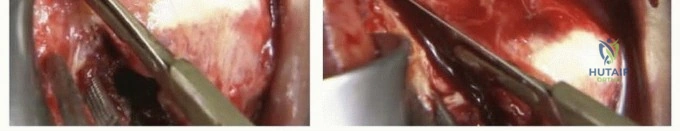Clinical Image